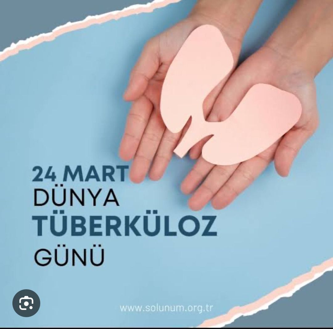 Tüberkülozun Toplumsal Etkilerine Dikkat Çekmek İçin 24 Mart Özel Etkinlikleri